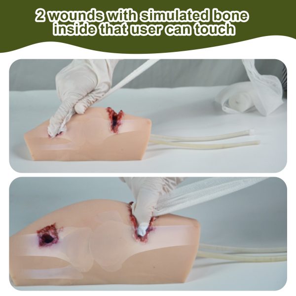 Knee Wound Model with Simulated Bone - Image 2