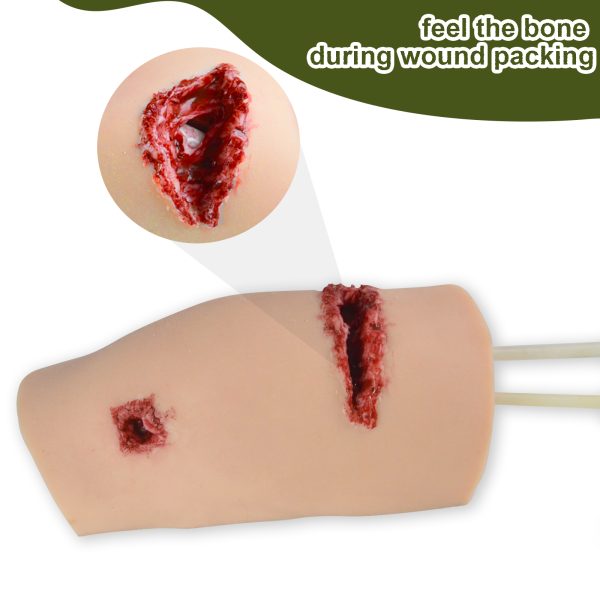 Knee Wound Model with Simulated Bone - Image 3