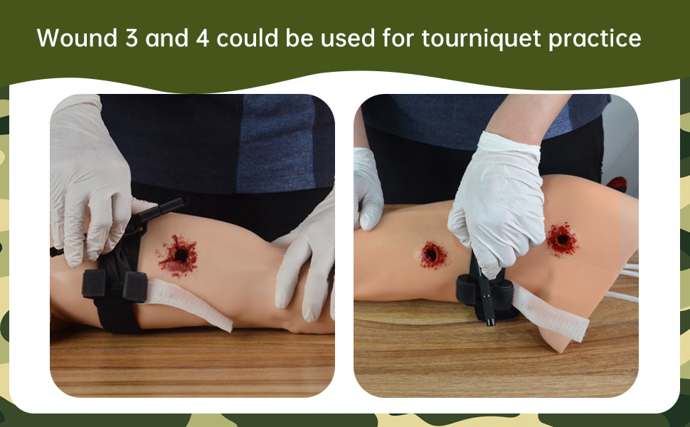 Stop-the-bleeding-kit