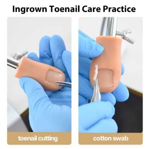 ingrown toenail care practice kit