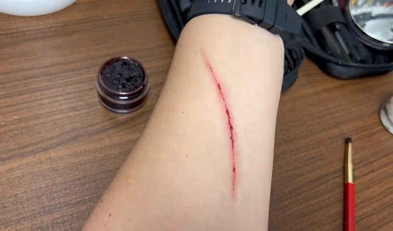 What Is an Example of an Incision Wound?