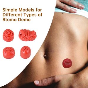 Ostomy-Model-Set