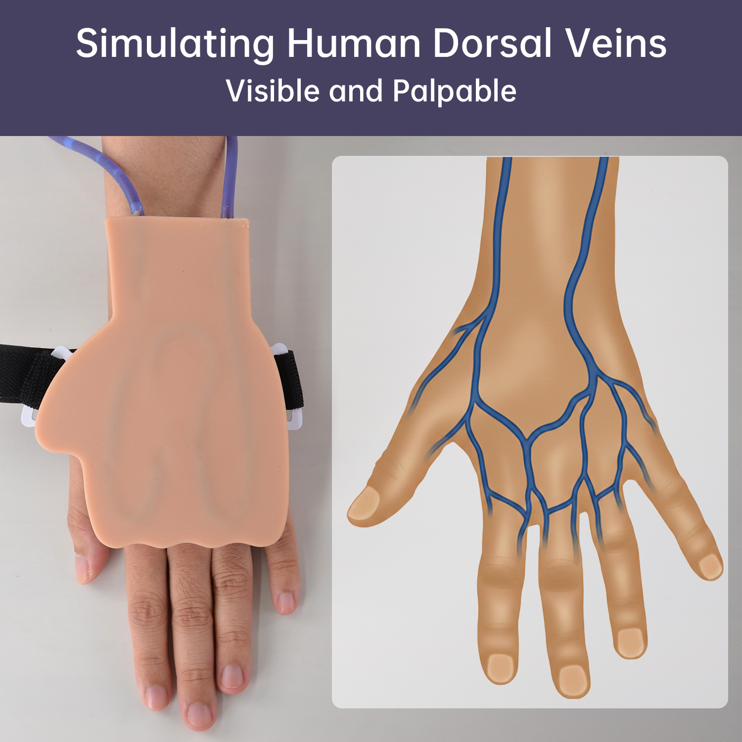 dorsal IV injection