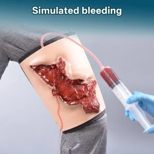 2aebd00654d229be3555e6aebbffb22a avulsion wound