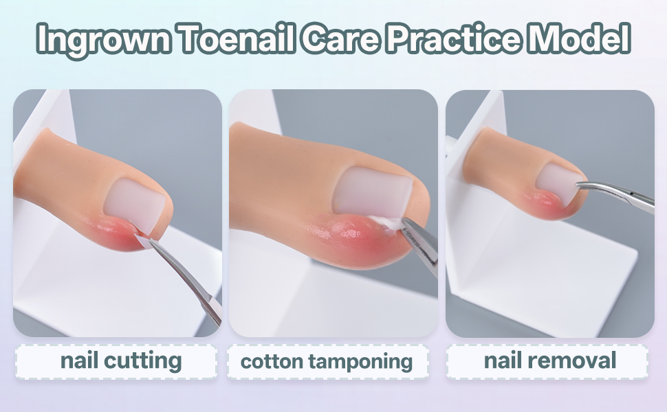 Ingrown toenail training model on base