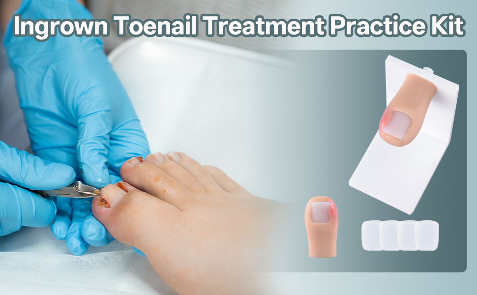 Ingrown toenail trainer with replaceable toes and nails