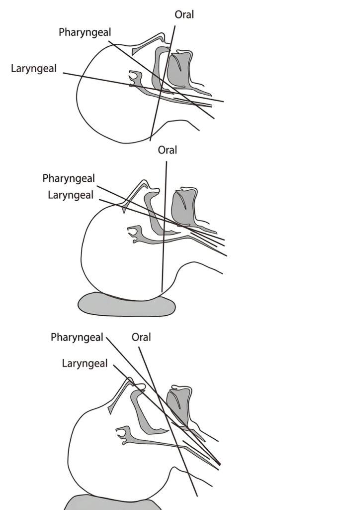 Alignment of three airway axes