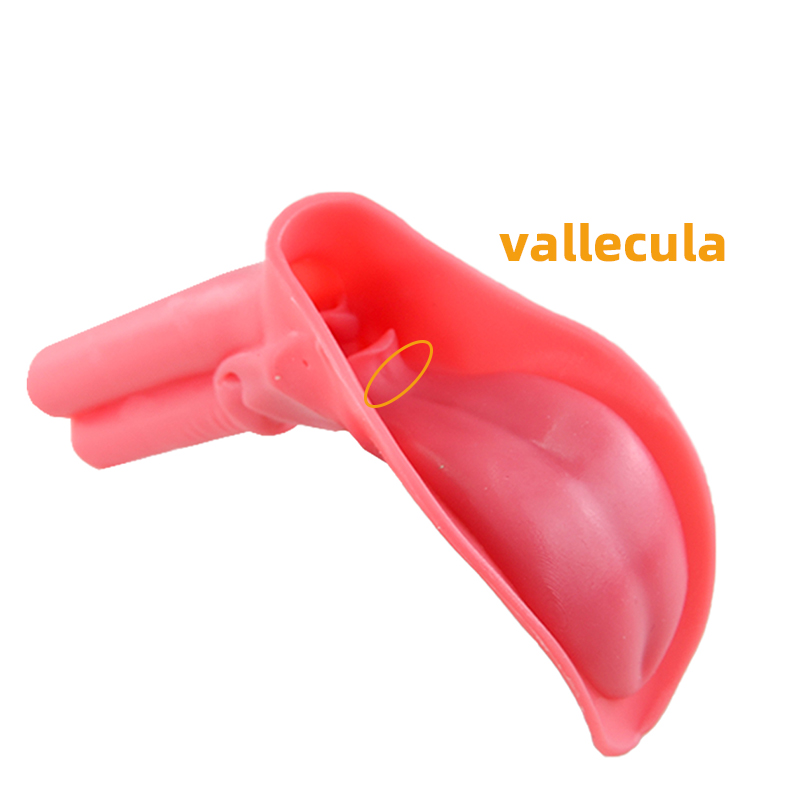 epiglottic vallecula