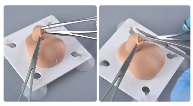 Infant Circumcision: Benefits, Risks, and How to Decide