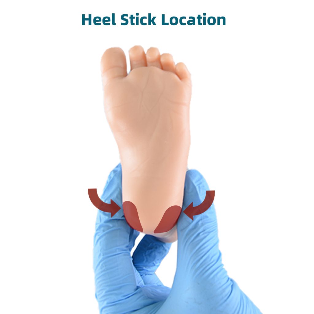 heel stick location