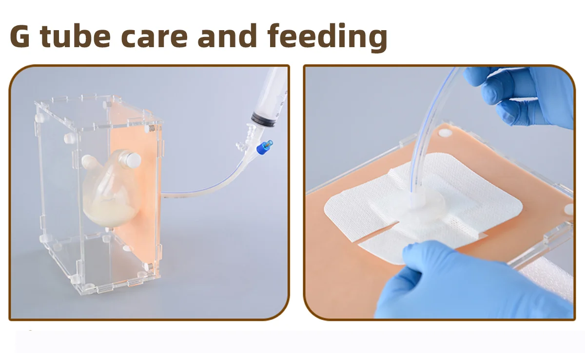 g tube care