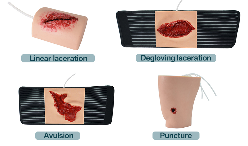 comparison of laceration avulsion and puncture wound types