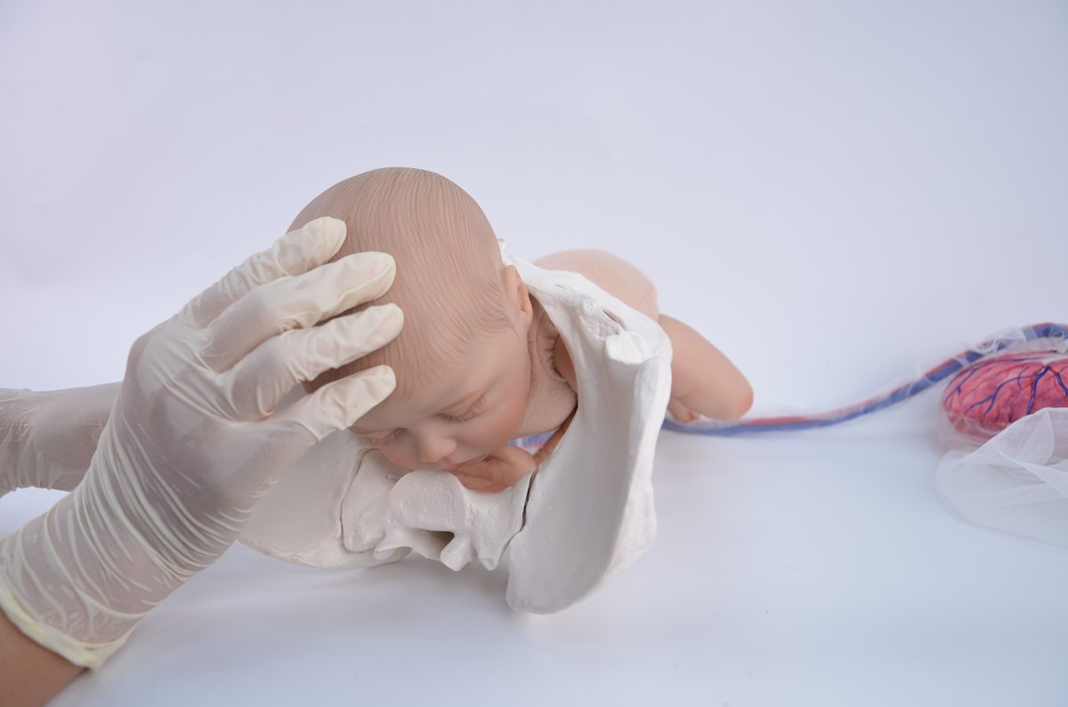 Fetal doll head lifting up and out of a pelvis model under the pubic bone