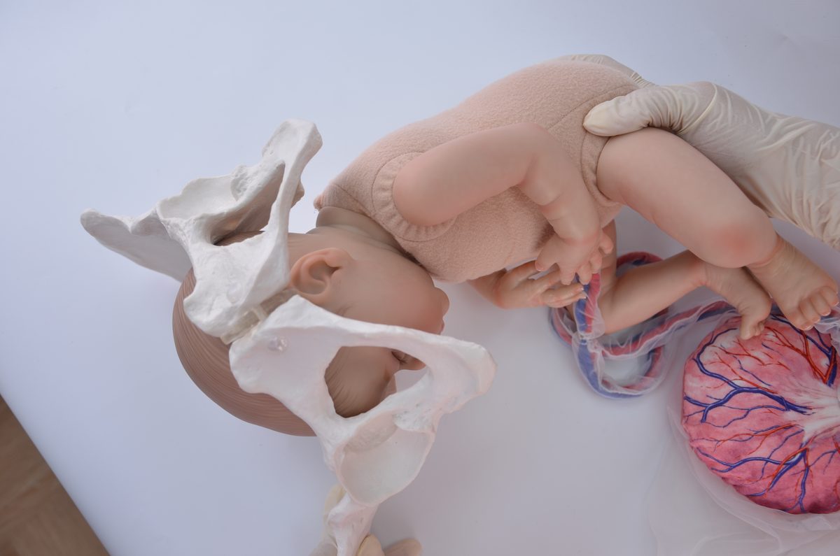Fetal doll with its chin tucked to the chest as the head passes through a pelvis model