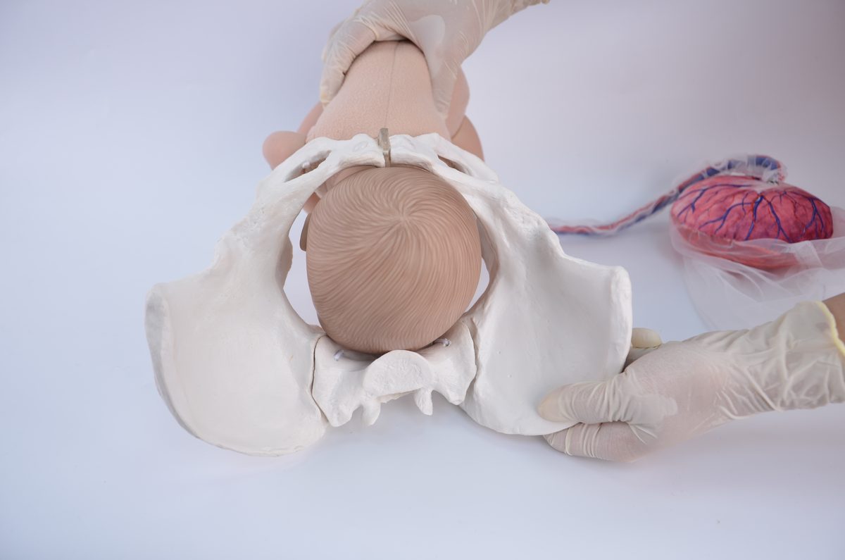 Fetal doll head turned front to back inside a pelvis model, viewed from below, with the back of the head toward the pubic bone