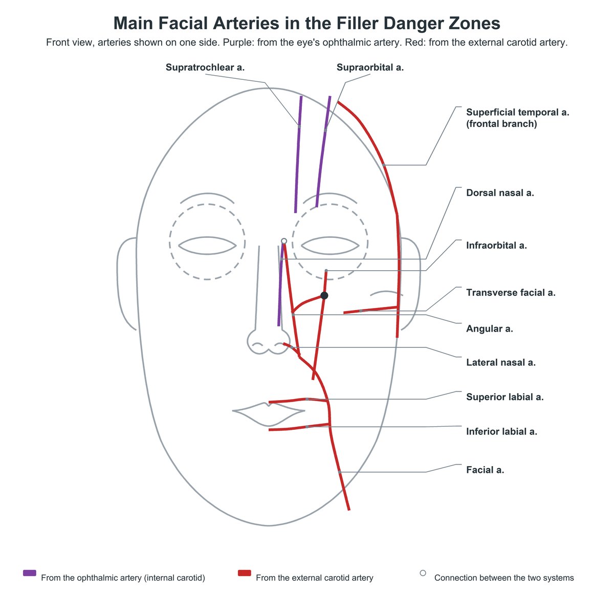 Front-view diagram of the main facial arteries in the filler danger zones, with ophthalmic branches in purple and external carotid branches in red